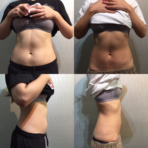 パーソナルトレーニングでダイエット① 画像